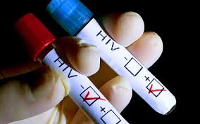 HIV
